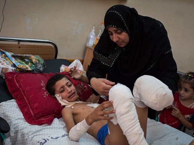 GAZA injured kid with his mother