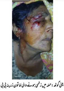 Widow Severely Injured in Brick and Stick Attack Over Grazing Dispute in Laloo Nach