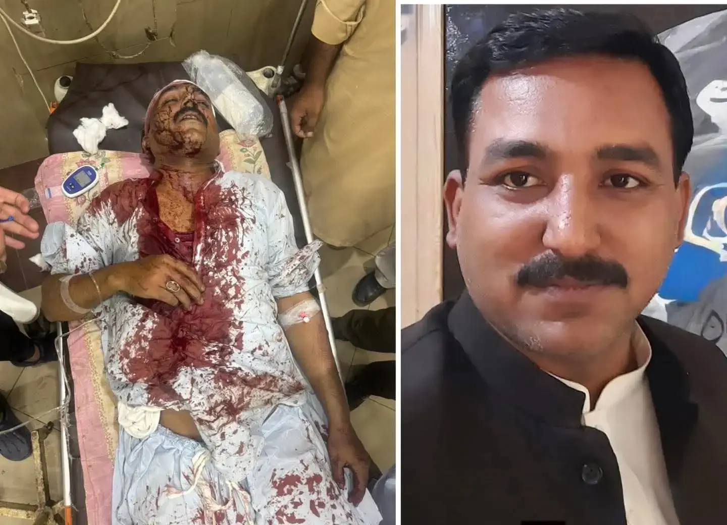 Brutal Attack on Journalist Mian Zahid Owaisi is an Attack on Press Freedom: Journalists Alliance