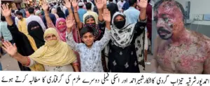 In Ahmadpur East, wife along with her lover throws acid on husband Shabbir Ahmed, burning him